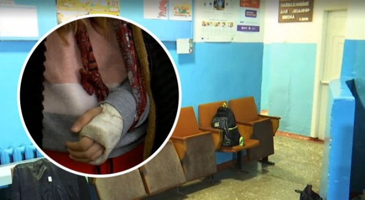 У школі під Одесою учениці на зламану руку поклали рибу і відправили додому: деталі скандалу